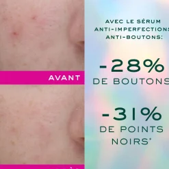 NUXE Sérum anti-imperfections anti-boutons Best Sale