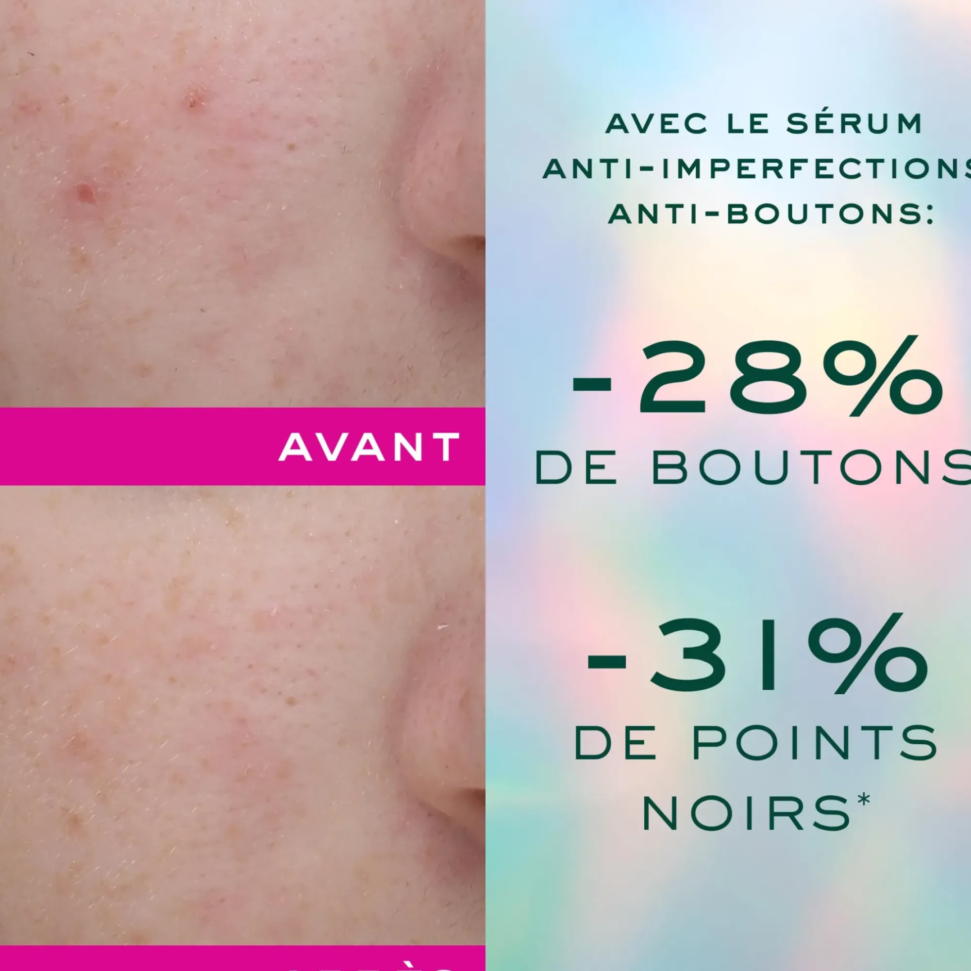 NUXE Sérum anti-imperfections anti-boutons - Trousse offerte Online